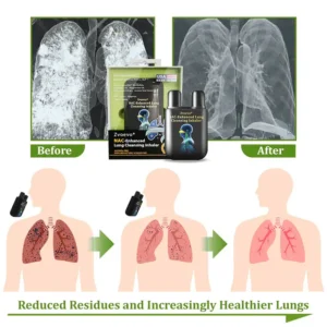 Zvoevo® NAC-Enhanced Lung Cleansing Inhaler image Zvoevo® NAC-Enhanced Lung Cleansing Inhaler