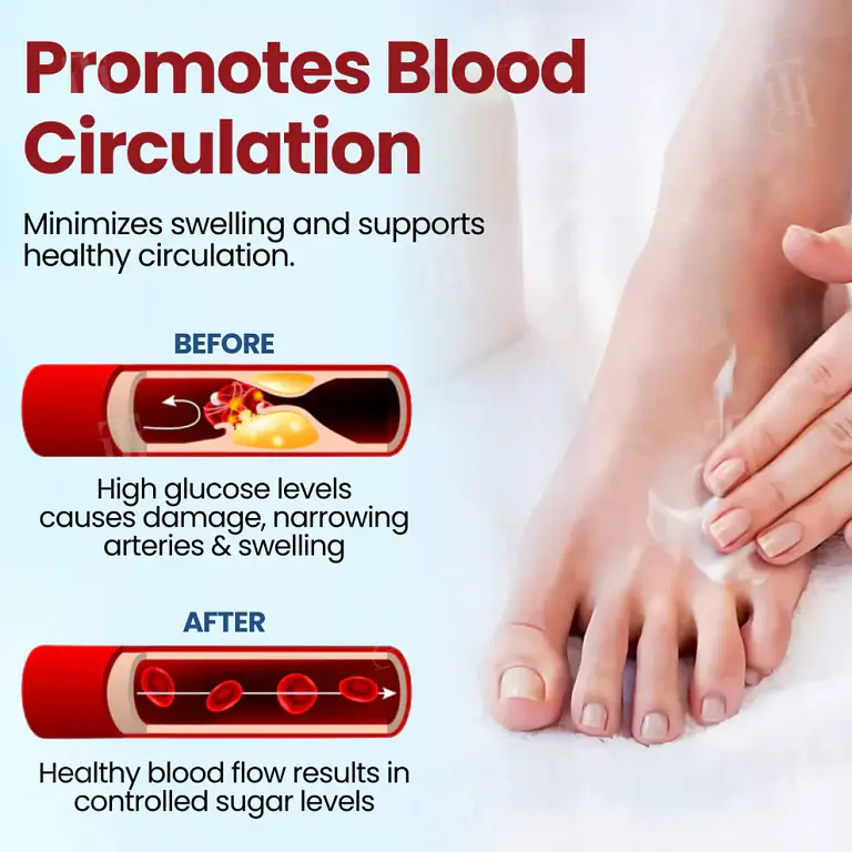 Cvreoz® Diabetic Foot Ulcer Repair Cream