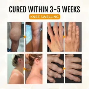 ArthriGone Magnesium Oil & Bee Venom Joint Care Spray image ArthriGone Magnesium Oil & Bee Venom Joint Care Spray