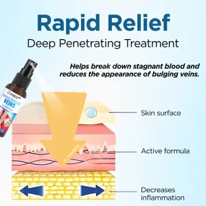 Cvreoz® Herbal Varicose Veins Treatment Spray