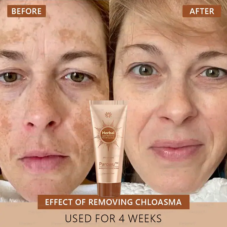 Parowu™ Whitening and Spot-Removing Face Mask Suitable 4 Parowu™ Whitening and Spot-Removing Face Mask Suitable