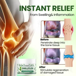 Cvreoz® Chillflex Mint Pain Relief Cream