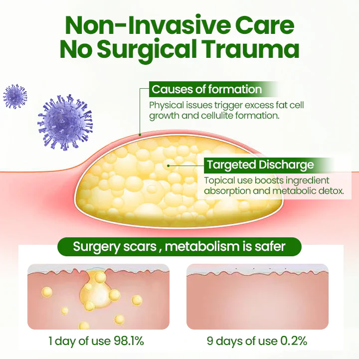 Cvreoz® KnotAway Lipoma Removal Cream