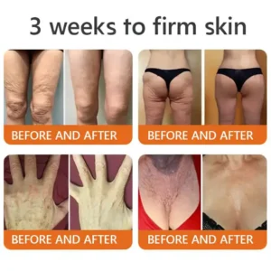 Cougex® “Dermal Gold” Botulin Bee Venom Skin Restoration Cream image Cougex® “Dermal Gold” Botulin Bee Venom Skin Restoration Cream