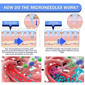 AAFQ® Nano Μicroneedle Patch with SΜGT GLP 1