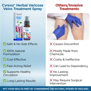 Cvreoz® Herbal Varicose Veins Treatment Spray