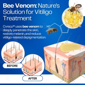 Cvreoz® VitiClear Bee Venom Cream