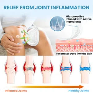 Cvreoz® Joint Relief HA Microneedle Patch