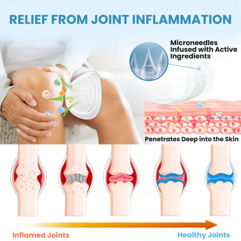 Cvreoz® Joint Relief HA Microneedle Patch