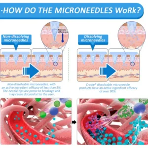 CROAIE® Nail Fungus Care Patches® Nano Microneedle Patch with SMGT-GLP-1 image CROAIE® Nail Fungus Care Patches® Nano Microneedle Patch with SMGT-GLP-1