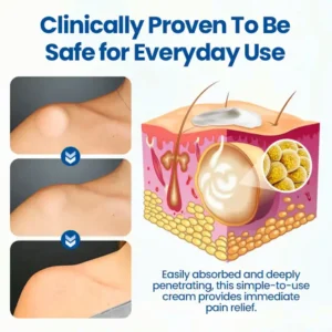Cvreoz® Lipoma Removal Cream