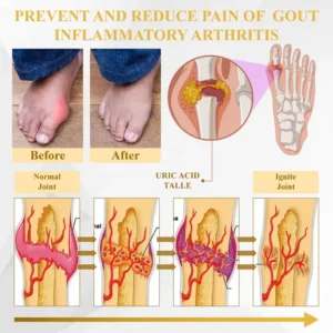 ATTDX® ApiMotion Herbal Joint Comfort Balm