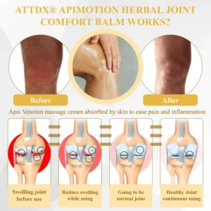 ATTDX® ApiMotion Herbal Joint Comfort Balm