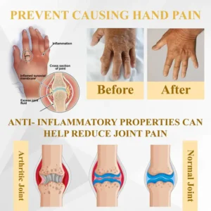 ATTDX® ApiMotion Herbal Joint Comfort Balm