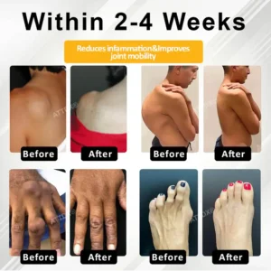 ATTDX® ApiMotion Herbal Joint Comfort Balm