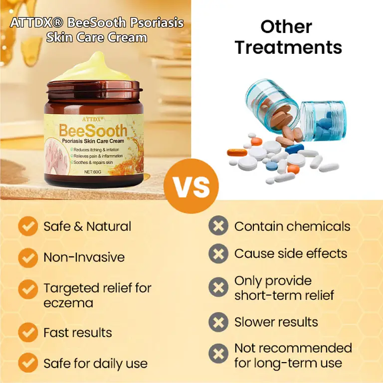 ATTDX® BeeSooth Psoriasis Skin Care Cream