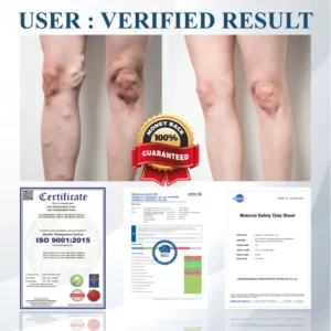 ATTDX® Black Cumin Edema Soothing Herbal Cream image ATTDX® Black Cumin Edema Soothing Herbal Cream