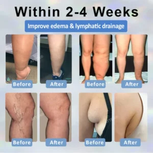 ATTDX® Black Cumin Edema Soothing Herbal Cream image ATTDX® Black Cumin Edema Soothing Herbal Cream