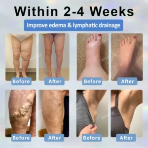 ATTDX® Black Cumin Edema Soothing Herbal Cream image ATTDX® Black Cumin Edema Soothing Herbal Cream