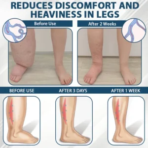 ATTDX® Black Cumin Edema Soothing Herbal Cream image ATTDX® Black Cumin Edema Soothing Herbal Cream