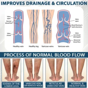 ATTDX® Black Cumin Edema Soothing Herbal Cream image ATTDX® Black Cumin Edema Soothing Herbal Cream