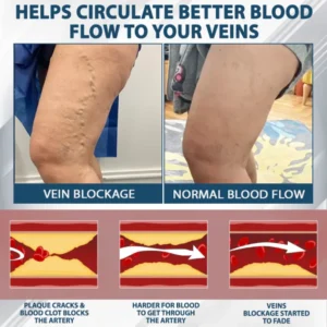 ATTDX® Black Cumin Edema Soothing Herbal Cream image ATTDX® Black Cumin Edema Soothing Herbal Cream