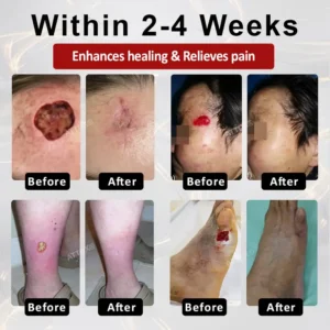 ATTDX® GlucoseGuard Skin Rescue Cream image ATTDX® GlucoseGuard Skin Rescue Cream