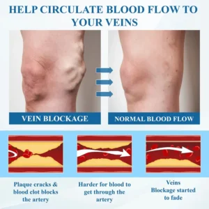 ATTDX® VeinFocus Microneedle Leg Patch