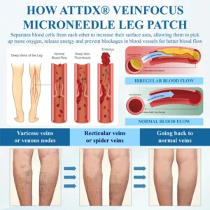 ATTDX® VeinFocus Microneedle Leg Patch