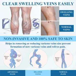 ATTDX® VeinFocus Microneedle Leg Patch