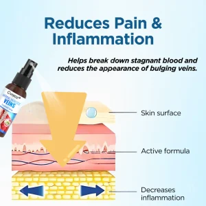 Cvreoz® Herbal Varicose Veins Treatment Spray