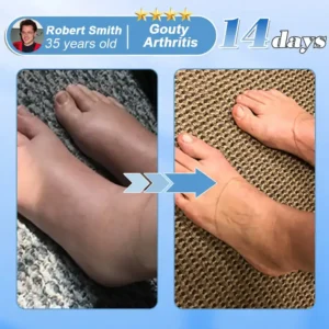 EQVP® Official Store Hyaluronic Acid Nano-microneedle Joint Patch