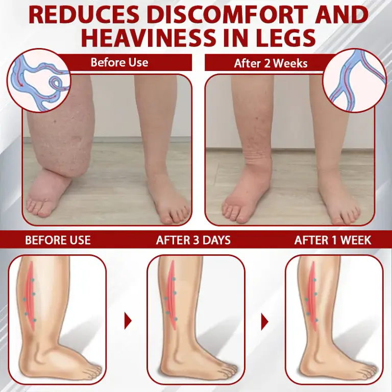 ATTDX® Red Vine FluidRelief Edema Gel