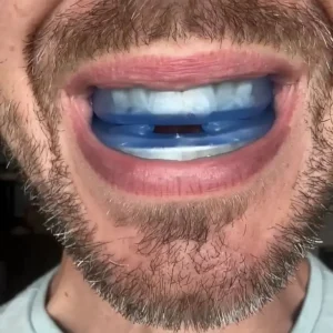 Anti-Snoring Mouthpiece™