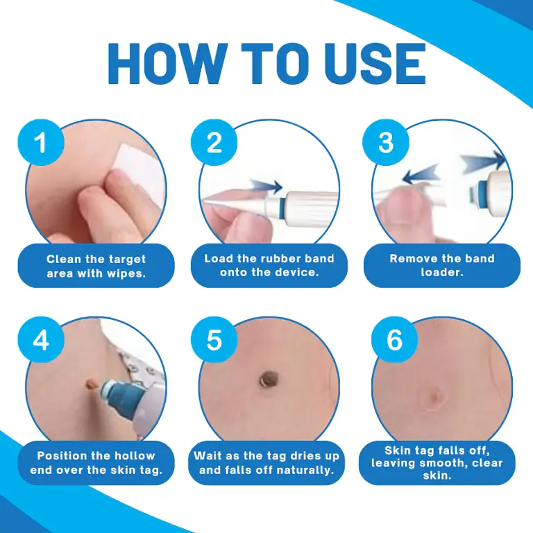 RICPIND® TagAway Home Touch Pen Kit