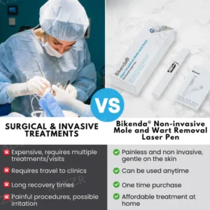 Bikenda® EXTRA Non-Invasive Mole and Wart Removal Laser Pen