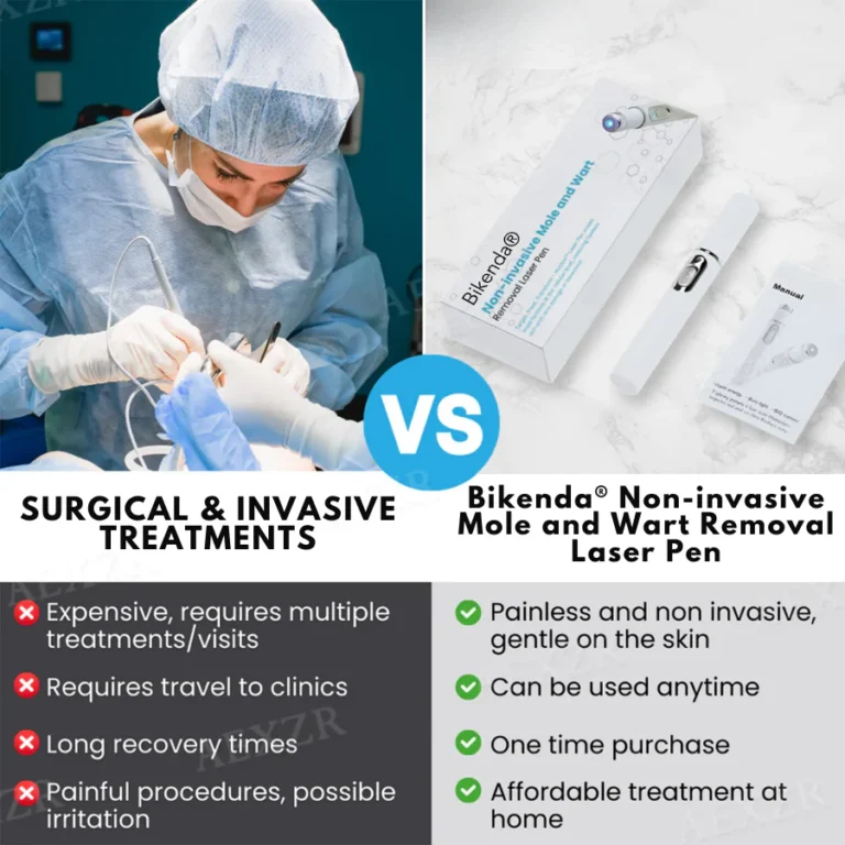 Bikenda® EXTRA Non-Invasive Mole and Wart Removal Laser Pen