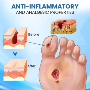 Cvreoz® Diabetic Foot Healing Cream