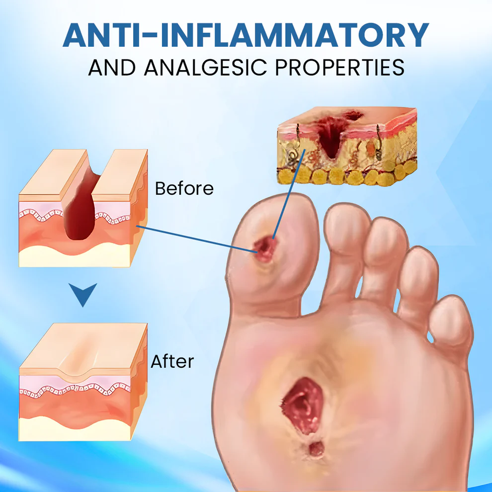Cvreoz® Diabetic Foot Healing Cream