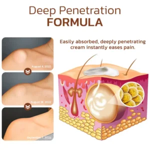 Cvreoz® Lumpless Lipoma Treatment Cream image Cvreoz® Lumpless Lipoma Treatment Cream