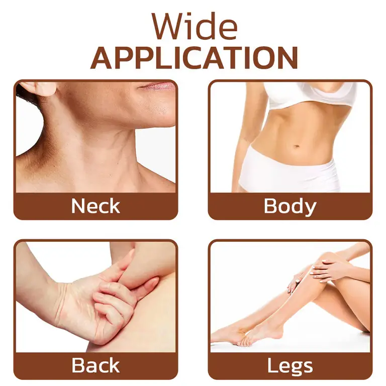 Cvreoz® Lumpless Lipoma Treatment Cream image Cvreoz® Lumpless Lipoma Treatment Cream