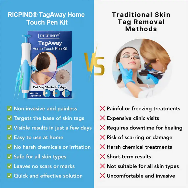 RICPIND® TagAway Home Touch Pen Kit