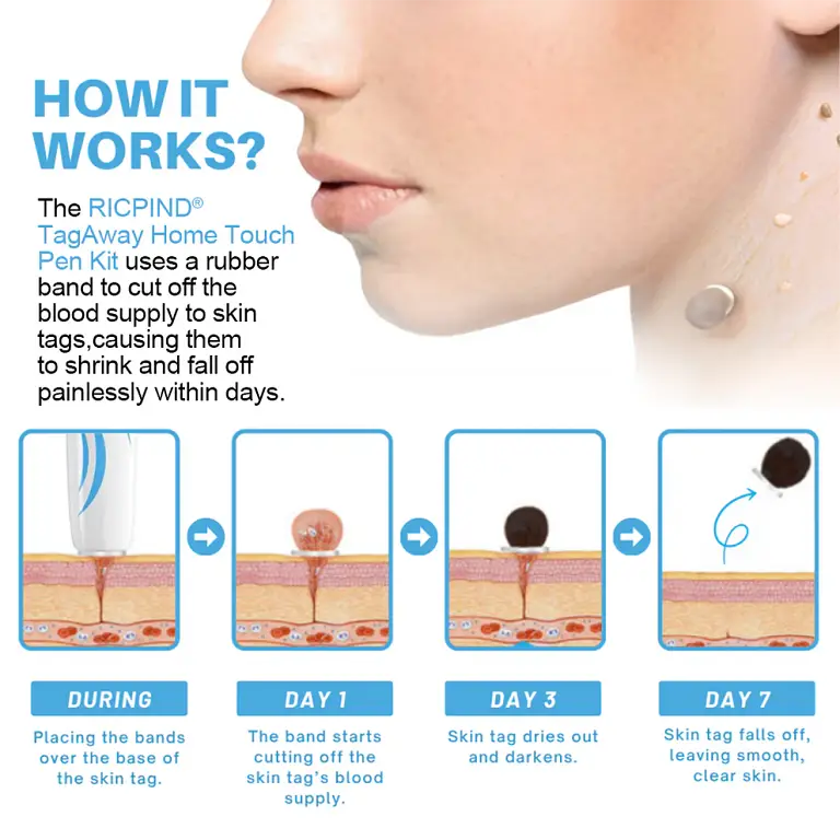 RICPIND® TagAway Home Touch Pen Kit