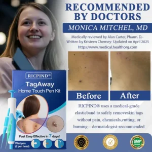 RICPIND® TagAway Home Touch Pen Kit