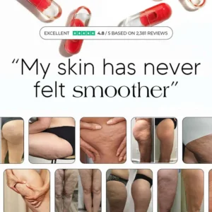 Maximum Potency Anti-Cellulite & Lipedema Capsules | Smooth Skin by Sculptique™