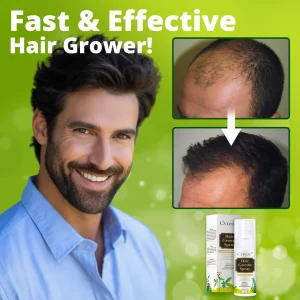 CVREOZ® Nourish & Flourish Hair Growth Spray