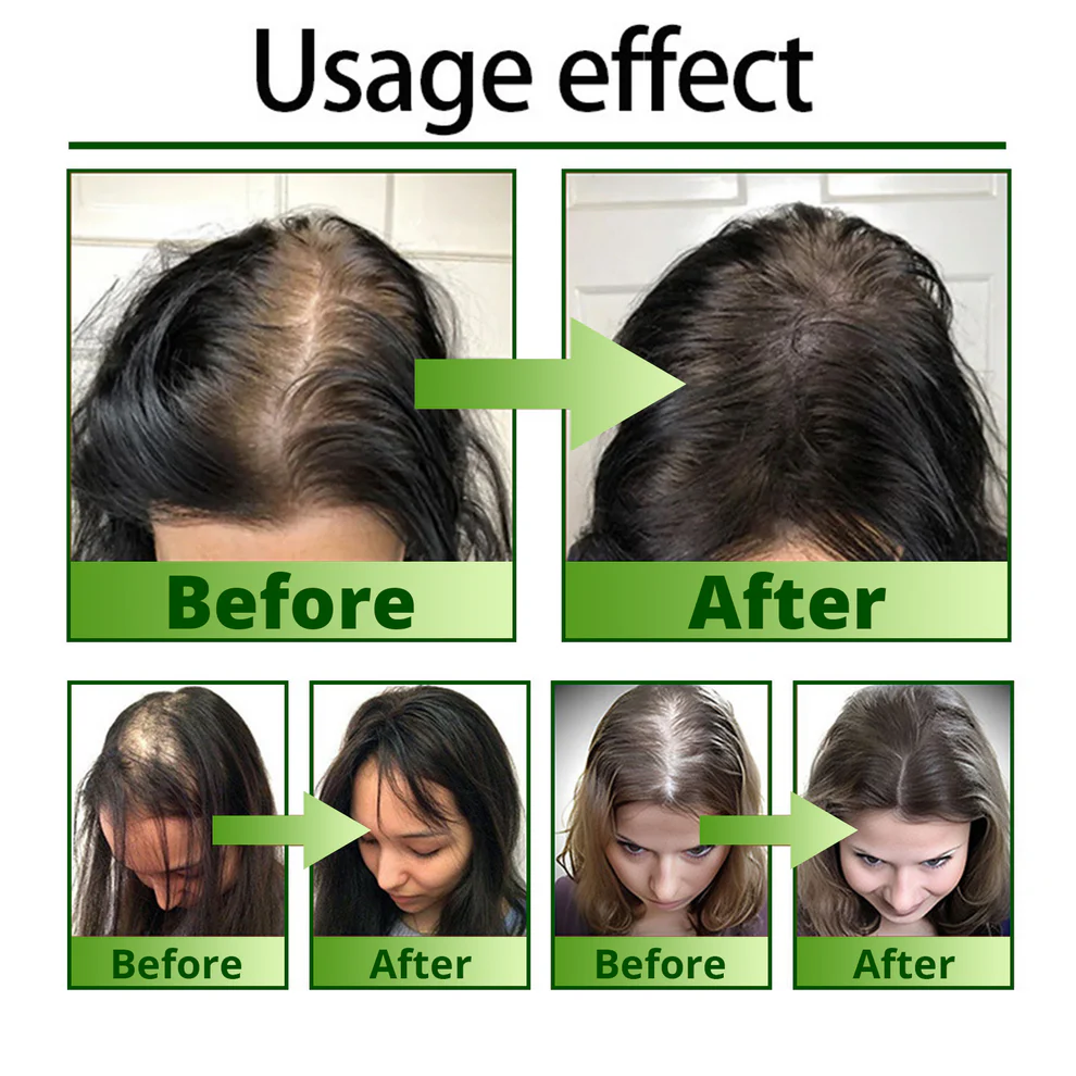 CVREOZ® Nourish & Flourish Hair Growth Spray