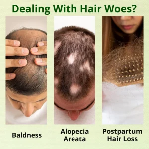 CVREOZ® Nourish & Flourish Hair Growth Spray