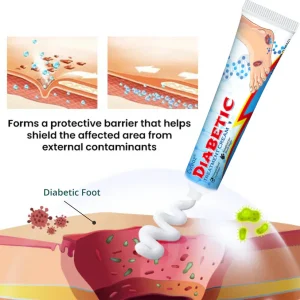 CVREOZ® BioVitaGlyco Diabetes Treatment Cream