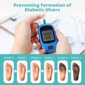 CVREOZ® BioVitaGlyco Diabetes Treatment Cream